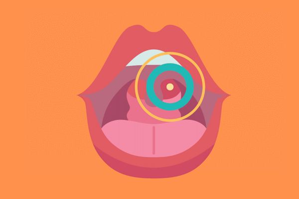 Rak ustne votline tako pri moških kot ženskah.